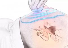 做超声影像（四维彩超）时，如何让胎宝宝配合检查？