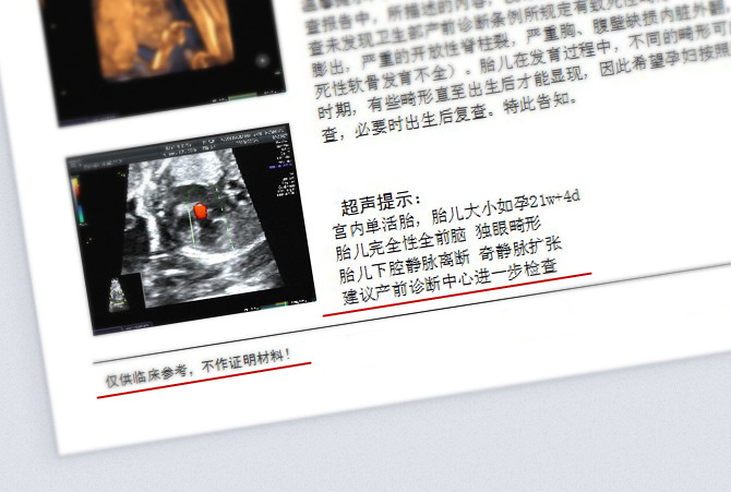 百佳超声影像筛查出前脑无裂畸形胎儿，这项检查不能忽视！